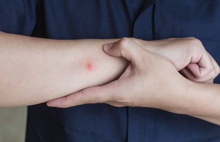 科普 | 人體是如何招致蚊子叮咬的，如何減少被叮咬？