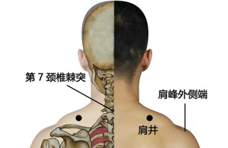 ?健康問(wèn)答 | 緩解頸椎“職業(yè)病”，如何進(jìn)行中醫(yī)調(diào)理？