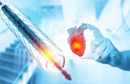 科技名詞 | 形狀記憶聚合物  shape memory polymers，SMP