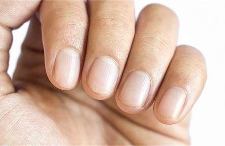 辟謠 | 指甲有豎紋，就是不健康？——指甲與健康