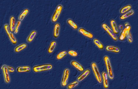 科技名詞 | 革蘭氏染色  Gram staining