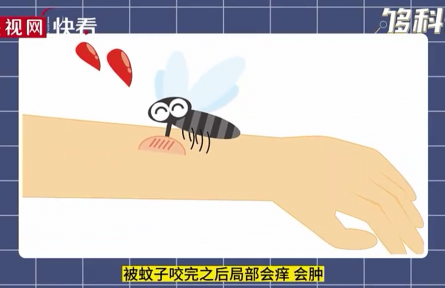 被蚊子叮咬后會(huì)越撓越癢嗎？