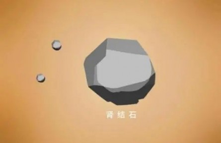 辟謠|腎結(jié)石患者不能補(bǔ)鈣？菠菜燉豆腐都不能吃了？