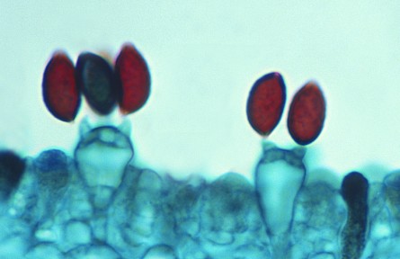 科技名詞|芽孢 spore，gemma