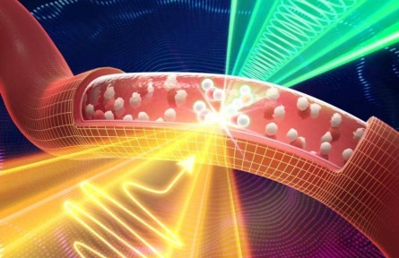 太赫茲+聲波！我國(guó)科學(xué)家使無針血鈉檢測(cè)成為可能